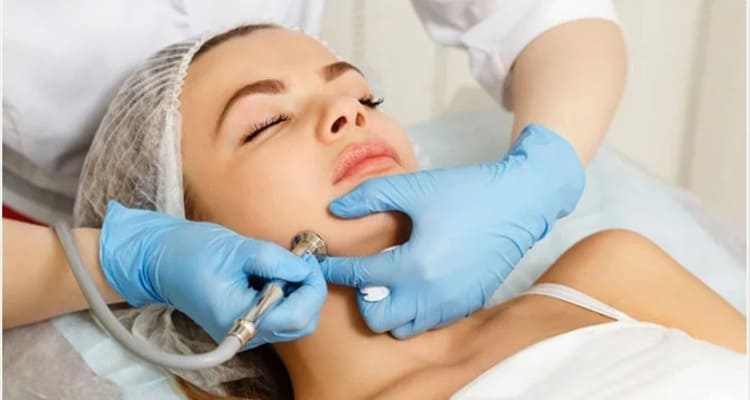 Dermabrasie Dermabrasie